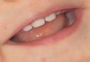 2015-12-16 - Toothy Grin