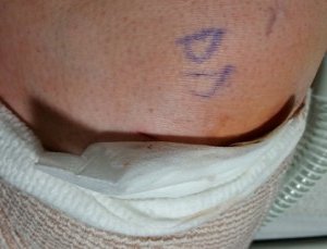2016-01-08 - Daddy's Knee