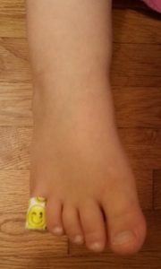 2018-08-26 - Bandaid On Toe